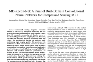 MD-Recon-Net: a parallel dual-domain convolutional neural network for compressed sensing MRI