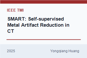 SMART: Self-supervised Learning for Metal Artifact Reduction in Computed Tomography Using Range Null Space Decomposition
